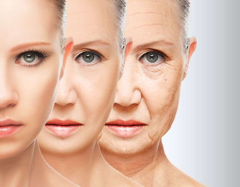Woman with facial aging 