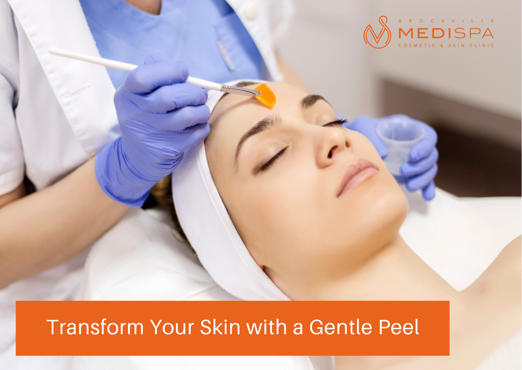 Tighten pores, reduce dark spots and boost collagen with a skin peel? Yes!